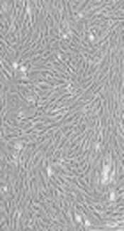 Prospect of Mesenchymal Stem Cells Conditioned Medium in Tissue Regeneration