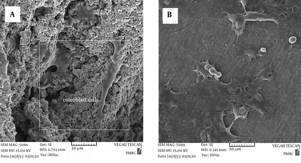 FESEM images of MG-63 cells on (a) uncoated and (b) coated surfaces